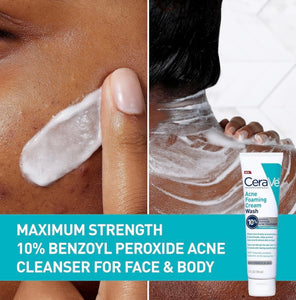 CeraVe Acne Foaming Cream Wash 10% Benzoyl Peroxide